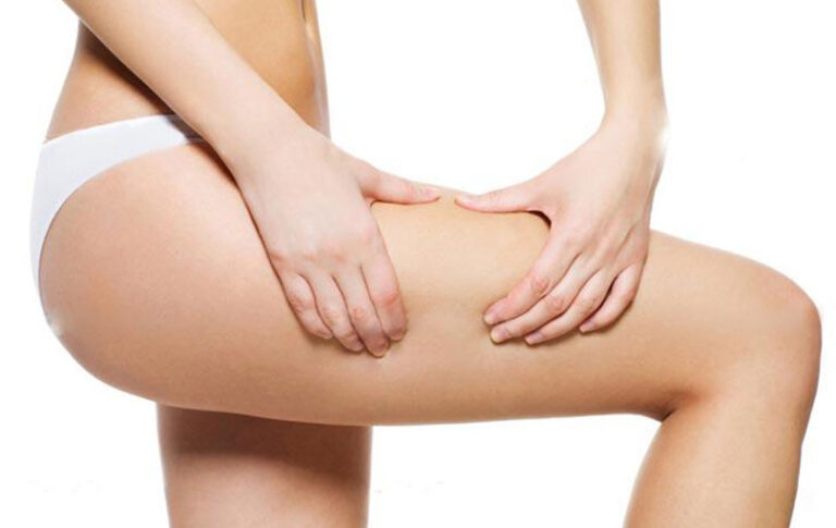 Jou dieet en water retensie